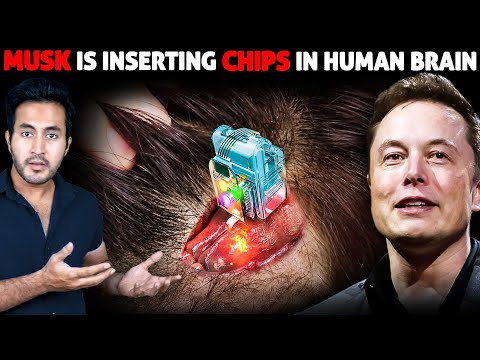 Neuralink HUMAN TRIALS Have Begun! ELON MUSK is Inserting Computer Chips Inside HUMAN BRAINS