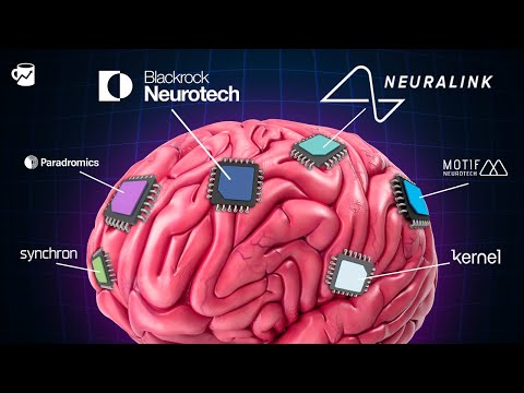 Companies Are Racing To Put A Chip In Your Brain